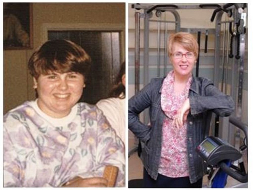 Dr Amanda Salis before and after weight loss. Dr Amanda Salis before and after weight loss.